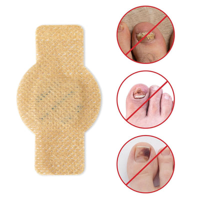 NailHeal™ - Fungal Nail Patches 🌿 ( Buy 1 Get 1 Free🔥)